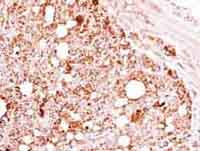 Immunohistochemistry analysis of paraffin-embedded NCI-N87 xenograft tissue labelling Hsp60 with ab137706 at 1/500.
