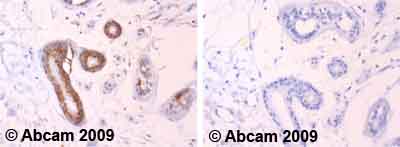 Ab59457 staining human normal skin tissue. Staining is localised to mitochondria.Left panel: with primary antibody at 2 ug/ml. Right panel: isotype control.Sections were stained using an automated system DAKO Autostainer Plus , at room temperature. Sections were rehydrated and antigen retrieved with the Dako 3-in-1 antigen retrieval buffer EDTA pH 9.0 in a DAKO PT Link. Slides were peroxidase blocked in 3% H2O2 in methanol for 10 minutes. They were then blocked with Dako Protein block for 10 minutes (containing casein 0.25% in PBS) then incubated with primary antibody for 20 minutes and detected with Dako Envision Flex amplification kit for 30 minutes. Colorimetric detection was completed with diaminobenzidine for 5 minutes. Slides were counterstained with Haematoxylin and coverslipped under DePeX. Please note that for manual staining we recommend to optimize the primary antibody concentration and incubation time (overnight incubation), and amplification may be required.
