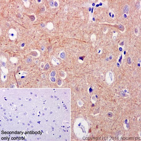 Immunohistochemical analysis of paraffin-embedded Human cerebral cortex tissue labeling HSPA12A with ab200838 at 1/100 dilution, followed by Goat Anti-Rabbit IgG H&L (HRP) (ab97051) at 1/500 dilution. Cytoplasmic staining on Human cerebral cortex tissue is observed. Counter stained with Hematoxylin.Secondary antibody only control: Used PBS instead of primary antibody, secondary antibody is Goat Anti-Rabbit IgG H&L (HRP) (ab97051) at 1/500 dilution.