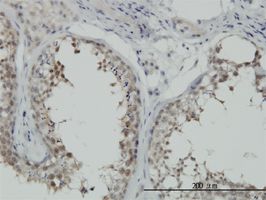 HSPA1B antibody (ab55288) used in immunohistochemistry at 6ug/ml on formalin fixed and paraffin embedded human testis.