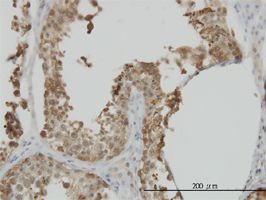 HSPA1L antibody (ab55289) used in immunohistochemistry at 3ug/ml on formalin fixed and paraffin embedded human testis.