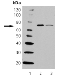 All lanes : Anti-HSPA6 antibody [165f] (ab69551) at 1/1000 dilutionLane 1 : Molecular Weight MarkersLane 2 : HSPA6 Recombinant ProteinLane 3 : HeLa Cell Lysate (Heat Shocked)developed using the ECL technique