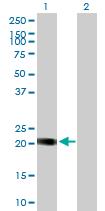 All lanes : Anti-HSPC111 antibody (ab88449) at 1 µg/mlLane 1 : Transfected 293T lysateLane 2 : Non-transfected lysateLysates/proteins at 25 µg per lane.