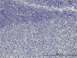 HSPC111 antibody (ab57134) used in immunohistochemistry at 3ug/ml on formalin fixed and paraffin embedded human tonsil.