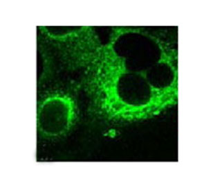 ab22112 at a 1/200 dilution staining HtrA3 in human bronchial cell line BEAS-2B by Immunocytochemistry/ Immunofluorescence. Cells were treated with 20µM etoposide for 24 hours.