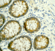 Immunohistochemical analysis of paraffin-embedded human colon using ab75982 at 1/100-1/250 dilution.