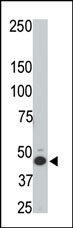 Anti-HtrA3 antibody (ab38608) at 1/100 dilution + Rat testis tissue lysate