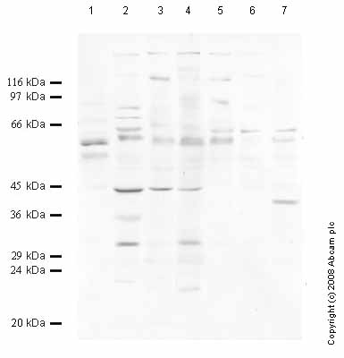 All lanes : Anti-HtrA3 antibody (ab65912) at 1/1000 dilutionLane 1 : Tissue lysate prepared from rat brain Lane 2 : Tissue lysate prepared from rat heart Lane 3 : Tissue lysate prepared from rat kidney Lane 4 : Tissue lysate prepared from rat liver Lane 5 : Tissue lysate prepared from rat lung Lane 6 : Tissue lysate prepared from rat ovary Lane 7 : Tissue lysate prepared from rat prostate