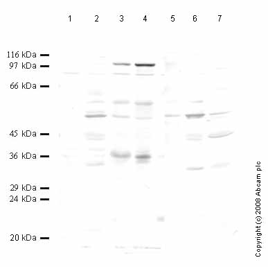 All lanes : Anti-HtrA3 antibody - Carboxyterminal end (ab65913) at 1/1000 dilutionLane 1 : Tissue lysate prepared from rat brainLane 2 : Tissue lysate prepared from rat heartLane 3 : Tissue lysate prepared from rat kidneyLane 4 : Tissue lysate prepared from rat liverLane 5 : Tissue lysate prepared from mouse brainLane 6 : Tissue lysate prepared from mouse heartLane 7 : Tissue lysate prepared from human heart