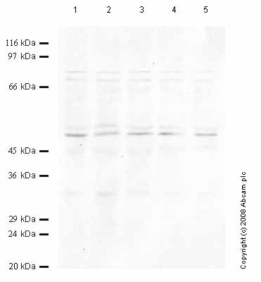 All lanes : Anti-htrA4 antibody (ab65916) at 1/1000 dilutionLane 1 : Tissue lysate prepared from rat prostate (1:10) at 30 µlLane 2 : Tissue lysate prepared from rat prostate (1:10) at 25 µlLane 3 : Tissue lysate prepared from rat prostate (1:10) at 20 µlLane 4 : Tissue lysate prepared from rat prostate (1:10) at 15 µlLane 5 : Tissue lysate prepared from rat prostate (1:10) at 10 µl