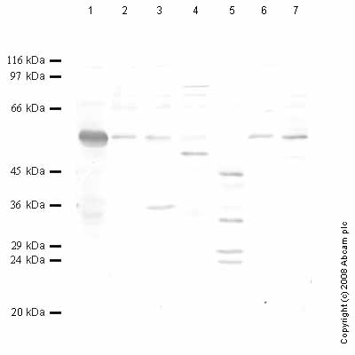 All lanes : Anti-htrA4 antibody - Carboxyterminal end (ab65917) at 1/1000 dilutionLane 1 : Tissue lysate prepared from rat brain Lane 2 : Tissue lysate prepared from rat lung Lane 3 : Tissue lysate prepared from rat ovary Lane 4 : Tissue lysate prepared from rat prostate Lane 5 : Tissue lysate prepared from rat skeletal muscle Lane 6 : Tissue lysate prepared from rat spleen Lane 7 : Tissue lysate prepared from rat testis