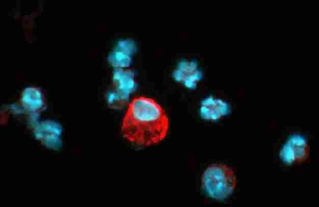 Detection of HIF-1-alpha (red dye) in a cell cytospin from a lavage of a murine skin pouch infected with Staph Aureus, using ab8366. 100X magnification. Blue dye is DAPI nuclear staining.Photos courtesy of Susan Alexander and Hattie Gresham, PhD.