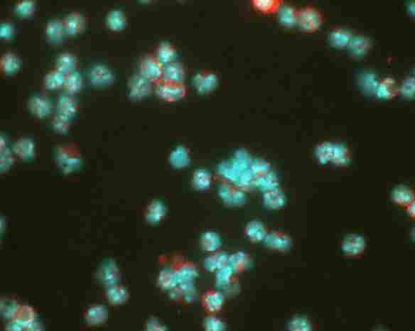 Detection of HIF-1-alpha (red dye) in a cell cytospin from a lavage of a murine skin pouch infected with Staph Aureus, using ab8366. Blue dye is DAPI nuclear staining.Photos courtesy of Susan Alexander and Hattie Gresham, PhD.