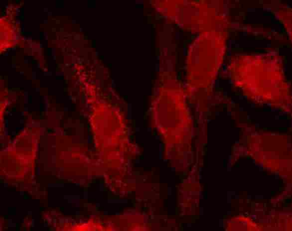 Detection of HIF-1-alpha (red dye 568) in a cultured raw mouse macrophage cell line, using ab8366. 100X magnification.Photos courtesy of Susan Alexander and Hattie Gresham, PhD.