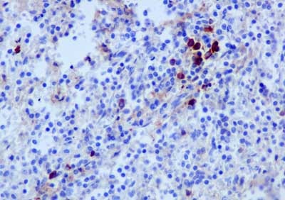 Immunohistochemical analysis of paraffin-embedded Human spleen tissue labeling Human IgG with ab181236 at 1/250 dilution, dilution followed by pre-diluted HRP-conjugated secondary antibody and counter-stained with Hematoxylin.