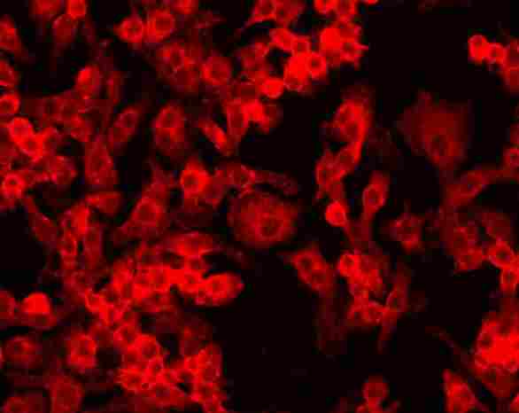 Detection of HIF-1-alpha (red dye 568) in a cultured raw mouse macrophage cell line, using ab8366.Photos courtesy of Susan Alexander and Hattie Gresham, PhD.
