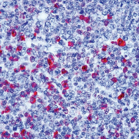 ab2410 staining IgG in human tonsil sections