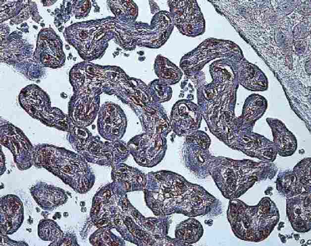 Immunohistochemistry (Formalin/PFA-fixed paraffin-embedded sections) analysis of hypoxia-induced Human placenta labeling HIF-1-alpha with ab8366.