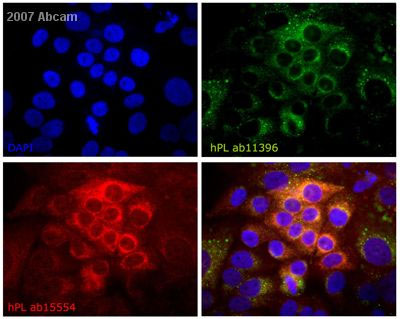 ab11396 at 1/100 staining human BeWo cells (placenta, choriocarcinoma) by ICC/IF. The cells were paraformaldehyde fixed and blocked with BSA prior to incubation with the antibody for 30 minutes. A FITC conjugated goat anti-mouse IgG antibody was used as the secondary antibody. The image is shown in the upper right hand panel. In this experiment ab15554 was used as a positive control (bottom left hand panel). Cells were counter stained with DAPI (upper left hand panel).See Abreview