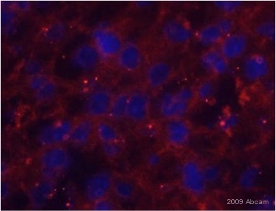 ab1 staining HIF-1-alpha in mouse liver tissue section by Immunohistochemistry (Frozen sections). Tissue samples were fixed with formaldehyde and permeablized with 0.2% Triton-X100 before blocking with 2% BSA for 30 minutes at 20°C. The sample was incubated with primary antibody (1/200) for 9 hours at 4°C. An Alexa Fluor®555-conjugated Goat polyclonal to mouse IgG was used as secondary antibody at 1/200 dilution. DAPI was used to stain the cell nuclei (blue).See Abreview