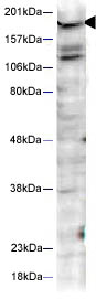 Anti-Huntingtin (phospho S421) antibody (ab2174) at 1/1000 dilution + human PC-3 cell lysateObserved band size : 190 kDa (why is the actual band size different from the predicted?)Additional bands at : 120 kDa,130 kDa. We are unsure as to the identity of these extra bands.