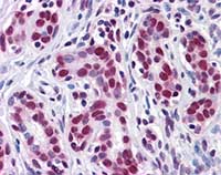 ab110081, at 10µg/ml, staining HuR / ELAVL1 in formalin-fixed, paraffin-embedded Human Breast tissue by Immunohistochemistry.
