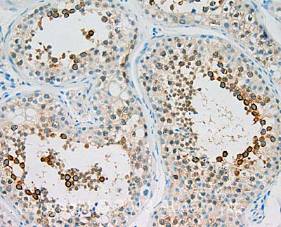 IHC image of HURP staining in Human Testis formalin fixed paraffin embedded tissue section, performed on a Leica Bond™ system using the standard protocol F. The section was pre-treated using heat mediated antigen retrieval with sodium citrate buffer (pH6, epitope retrieval solution 1) for 20 mins. The section was then incubated with ab70744, 1 µg/ml, for 15 mins at room temperature and detected using an HRP conjugated compact polymer system. DAB was used as the chromogen. The section was then counterstained with haematoxylin and mounted with DPX. For other IHC staining systems (automated and non-automated) customers should optimize variable parameters such as antigen retrieval conditions, primary antibody concentration and antibody incubation times.