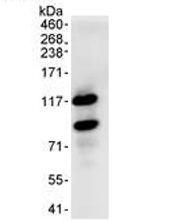 Detection of HURP by Western Blot of Immunprecipitate. ab70744 at 1µg/ml staining HURP in HeLa whole cell lysate immunoprecipitated using ab70744 at 3µg/mg lysate (1 mg/IP; 20% of IP loaded/lane). Chemiluminescence with exposure time of 10 seconds.