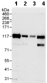 All lanes : Anti-HURP antibody (ab70744) at 0.04 µg/mlLane 1 : HeLa whole cell lysate at 50 µgLane 2 : HeLa whole cell lysate at 15 µgLane 3 : HeLa whole cell lysate at 5 µgLane 4 : 293T whole cell lysate at 50 µg