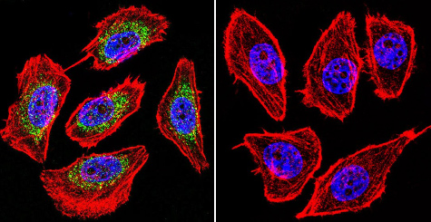 Immunocytochemistry/Immunofluorescence analysis of U251 cells labeling HIF-1-alpha with ab16066. HIF-1-alpha (green), F-Actin staining with Phalloidin (red) and nuclei with DAPI (blue) is shown. Cells were grown on chamber slides and fixed with formaldehyde prior to staining. Cells were probed without (control - right) or with ab16066 (left) at a dilution of 1/20 over night at 4°C and incubated with a DyLight-488 conjugated secondary antibody. Images were taken at 60X magnification.