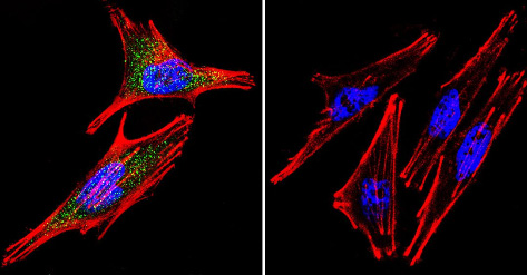Immunocytochemistry/Immunofluorescence analysis of A2058 cells labeling HIF-1-alpha with ab16066. HIF-1-alpha (green), F-Actin staining with Phalloidin (red) and nuclei with DAPI (blue) is shown. Cells were grown on chamber slides and fixed with formaldehyde prior to staining. Cells were probed without (control - right) or with ab16066 (left) at a dilution of 1/20 over night at 4°C and incubated with a DyLight-488 conjugated secondary antibody. Images were taken at 60X magnification.