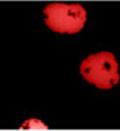 Immunocytochemistry/Immunofluorescence labeling HIF-1-alpha with ab16066.