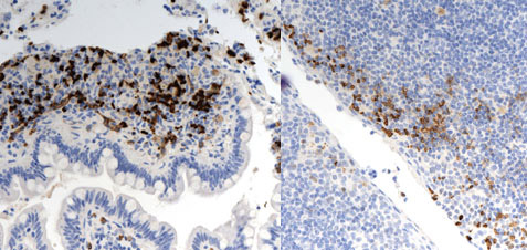 ab16066 staining HIF-1-alpha in Human small intestine (IBD) and tonsil tissue sections by Immunohistochemistry (IHC-P - paraformaldehyde-fixed, paraffin-embedded sections). Tissue was fixed with formaldehyde; antigen retrieval was by heat mediation with an EDTA buffer (pH 9.0). Samples were incubated with primary antibody (1/800 in diluent + background reducers) for 20 minutess at 25°C. An undiluted Goat polymer was used as the secondary antibody.See Abreview