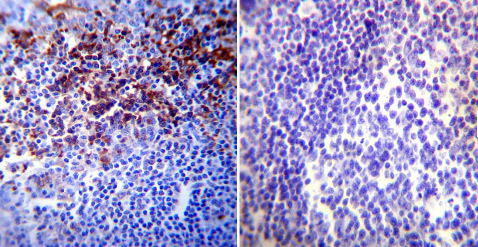 Immunohistochemistry was performed on normal biopsies of deparaffinized Human tonsil tissue. To expose target proteins heat induced antigen retrieval was performed using 10mM sodium citrate (pH6.0) buffer microwaved for 8-15 minutes. Following antigen retrieval tissues were blocked in 3% BSA-PBS for 30 minutes at room temperature. Tissues were then probed at a dilution of 1/20 with ab16066 (left) or without primary antibody (negative control - right) overnight at 4°C in a humidified chamber. Tissues were washed extensively with PBST and endogenous peroxidase activity was quenched with a peroxidase suppressor. Detection was performed using a biotin-conjugated secondary antibody and SA-HRP followed by colorimetric detection using DAB. Tissues were counterstained with hematoxylin and prepped for mounting.