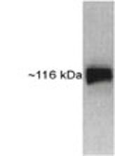 Anti-HIF-1-alpha antibody [mgc3] (ab16066) at 1/2000 dilution + HeLa cell lysate