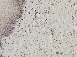 HYI antibody (ab57787) used in immunohistochemistry at 3ug/ml on formalin fixed and paraffin embedded human esophagus.