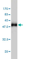 Western blot against tagged recombinant protein immunogen using ab57787 HYI antibody at 1ug/ml.