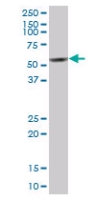 Anti-HYPE antibody (ab67163) at 1/500 dilution + human placenta tissue lysate at 25 µgSecondaryGoat Anti-Mouse IgG (H&L)-HRP Conjugate at 1/5000 dilution