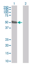 All lanes : Anti-HYPE antibody (ab67163) at 1/500 dilutionLane 1 : Transfected 293T cell lysateLane 2 : non Transfected 293T cell lysateLysates/proteins at 25 µg per lane.SecondaryGoat Anti-Mouse IgG (H&L)-HRP Conjugate at 1/5000 dilution