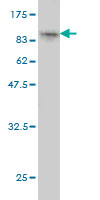 Western blot against tagged recombinant protein immunogen using ab57755 Hypothetical Protein FLJ21908 antibody at 1ug/ml.