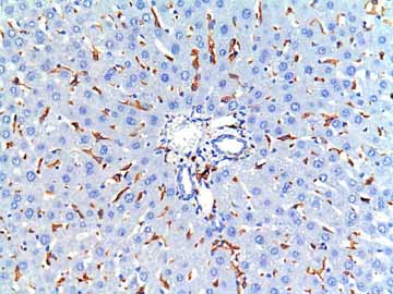 ab107159 staining Iba1 in Rat liver tissue sections by Immunohistochemistry (IHC-P - paraformaldehyde-fixed, paraffin-embedded sections). Tissue was fixed with formaldehyde and blocked with 1% BSA for 15 minutes at 20°C; antigen retrieval was by heat mediation in a citrate buffer. Samples were incubated with primary antibody (1/2000 in PBS + 1% BSA) for 1 hour at 20°C. An undiluted HRP-conjugated anti-goat IgG polyclonal was used as the secondary antibody. Kupffer cells are positive for Iba-1.See Abreview