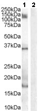 All lanes : Anti-Iba1 antibody (ab48004) at 1 µg/mlLane 1 : Human Peripheral Blood Mononucleocyte lysate in RIPA bufferLane 2 : Human Peripheral Blood Mononucleocyte lysate in RIPA buffer with blocking peptideLysates/proteins at 35 µg per lane.developed using the ECL technique