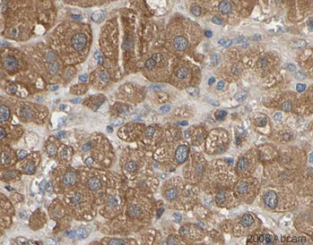 Image courtesy of Human Protein Atlasab20654 staining HIF-2-alpha in Adrenal gland. The paraffin embedded human tissue was incubated with ab20654(1:2500 dilution) for 30 mins at room temperature. Antigen retrieval was performed by heat induction in citrate buffer pH 6. Ab20654 was tested in a tissue microarray (TMA) containing a wide range of normal and cancer tissues as well as a cell microarray consisting of a range of commonly used, well characterised human cell lines.Further results for this antibody can be found at www.proteinatlas.org