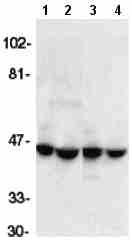 All lanes : Anti-ICAD antibody (ab8409) at 1/1000 dilutionLane 1 : HeLa whole cell lysateLane 2 : Jurkat whole cell lysateLane 3 : A431 whole cell lysateLane 4 : K562 whole cell lysateObserved band size : 45 kDa (why is the actual band size different from the predicted?)