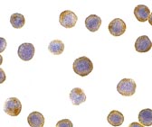 ab8409 at 5µg/ml staining ICAD in Hela cells by ICC/IF