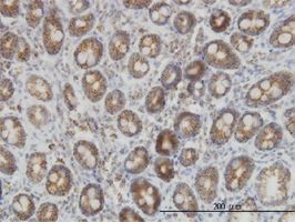 IDH2 antibody (ab55271) used in immunohistochemistry at 3ug/ml on formalin fixed and paraffin embedded human colon.