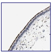 Immunohistochemical staining of paraffin embedded Human nasopharynx tissue, using 1/25 ab121243, shows strong membranous positivity in respiratory epithelial cells.