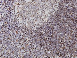 IFI16 antibody (ab55328) used in immunohistochemistry at 3ug/ml on formalin fixed and paraffin embedded human tonsil.
