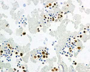 Immunohistochemical analysis of formalin-fixed, paraffin-embedded Human bone marrow tissue labeling IFI16, using ab169788 at a 1/100 dilution.