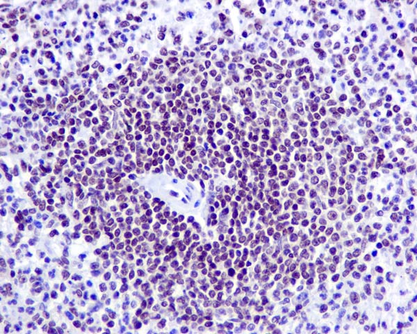 ab169788 showing +ve staining in Human normal spleen tissue.